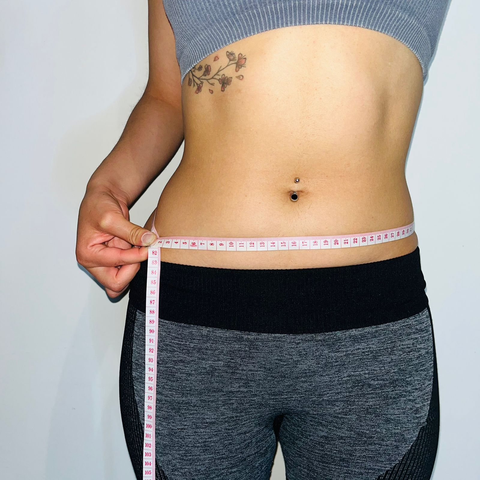 Fisioterapeuta realizando electrolipólisis en Cefire